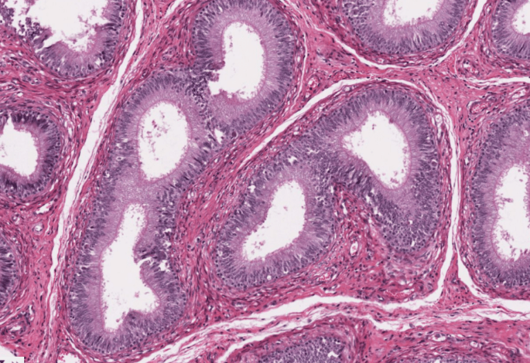 APARATO REPRODUCTOR MASCULINO – ATLAS DE HISTOLOGÍA